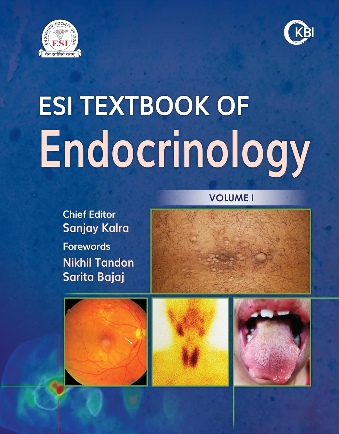 ESI Textbook of Endocrinology 2 volumes